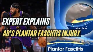 Expert Explains Lakers Anthony Davis Plantar Fasciitis Injury