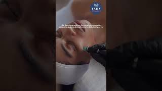 The science behind Hydrafacial Syndeo @ Yada Clinic Pattaya