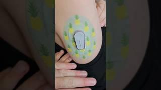 Dexcom Swap Early due to error #diabetes #t1d #dexcom #expressionmed #typeonediabetes #diabadass