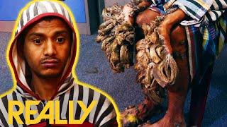 “The Tree Man From Bangladesh” | Body Bizarre