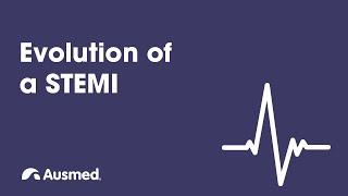 Evolution of a STEMI | Ausmed Explains...