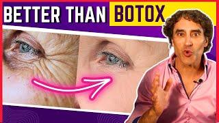 ERASE CROWS FEET IN DAYS WITHOUT BOTOX !!