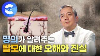 탈모는 왜 생길까? 증상, 원인, 치료법, 예방