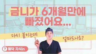 금니가 6개월만에 빠졌는데 다시 붙여주나요? [헬닥 지식in]