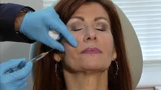 Dr. Jason Bloom's Cheek Challege for Mid-Face or Cheek Lifting and Filling