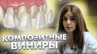 Композитные виниры на здоровые зубы - это вредно? СТУДИЯ УЛЫБОК Стоматология Сочи.