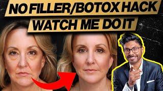 How to tighten Your Face Without Filler / Botox (live demo)