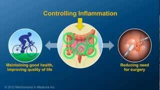 Chronic Inflammation in IBD and How Anti-TNF Therapy Works