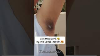 Best Home Remedies For Dark Underarms  #shorts #skincare Smbeautylandstudio