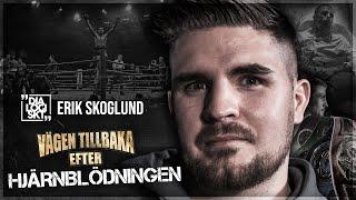 Erik Skoglund,#143, "Hjärnblödningen och vägen tillbaka"#dialogiskt