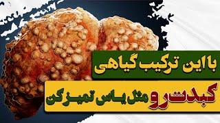 پاکسازی خون و کبد | درمان کبد چرب با گیاهان دارویی معجزه‌آسا Cleansing the blood and fatty liver