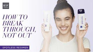 How To Video: Fight Teen Acne with Spotless