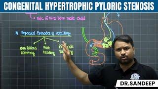 Congenital Hypertrophic Pyloric Stenosis | Surgery | Bailey learned with Dr. Sandeep | PW MedEd