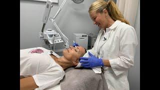 Microneedling and how does microneedling work || Live GenXtra (My Experience)