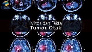 Mitos dan Fakta Tumor Otak