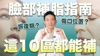 臉部補脂百科！術後甭冰敷？眼窩凹也能補？建議請假X天 才不容易發現｜新聖整形外科 林子宇醫師