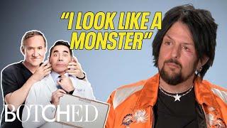 Botched FACE PROCEDURES That Are Difficult to Face | Botched | E!
