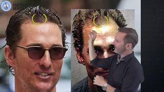 Matthew McConaughey Hair Transplant Results or A Good Wig?