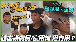 素人直擊！淚溝改善之迷 | 淚溝唔係黑眼圈？| Teosyal 透明質酸 醫生療程全程直擊！| 狂試護膚品/家用醫美療器居然無效？| Teosyal超詳細講解 |