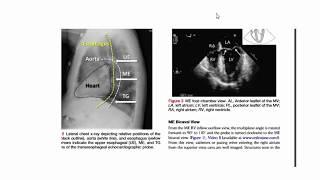 Basics of Transesophageal Echocardiography, Dr. Mohammad Saber