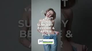 7 Best Weight Loss Surgery Before and After Pictures