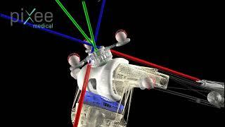 EXPERIMENTAL VALIDATION OF PATELLAR TRACKING AND CONTACT SIMULATION OF DIGITAL TWINS AFTER TKR