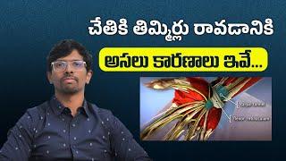 చేతుల్లో తిమ్మిర్లు ఎందుకు వస్తాయి || Carpal tunnel syndrome - Symptoms and causes || Dr.Vamshi