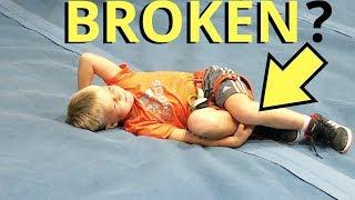 BROKEN LEG ROCK CLIMBING!?!?! 