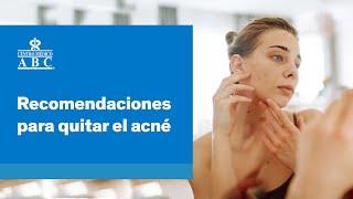 Recomendaciones para quitar el acné