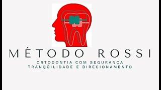 Método Rossi- segurança e facilidade na clínica de ortodontia e ortopedia