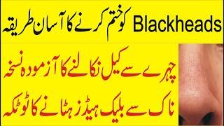 blackheads khatam karne ka asan tariqa | Do this to get rid of black heads From Your Nose in Urdu