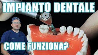 Impianto dentale fisso 1/3