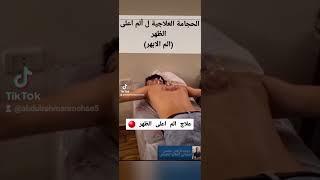 cupping therapy for upper back pain