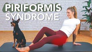 Buttock pain? Try this exercise right now! (Piriformis Syndrome)