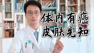 【英德中医何医生】体内有癌，皮肤先知？皮肤3个特殊的改变，才需要担心癌症来袭