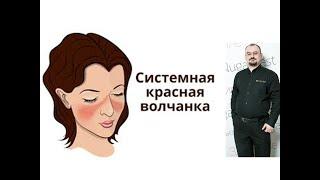 Системная красная волчанка - представление