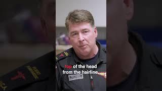Serious Chainsaw Head Injury - What Happens Next In ER! #shorts #emergency #paramedics