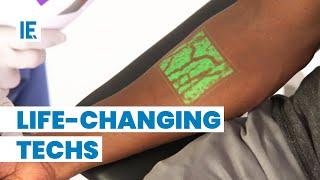 20 Life-Changing Medical Inventions