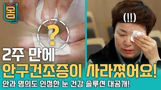 [Full] 2주 만에 안구 건조증이 사라졌어요!ㅣ귀하신 몸ㅣ44화 눈이 아프고 뻑뻑하고 침침하다면?