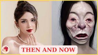 55 Celebrity Plastic Surgery Disasters Full Album | Then and Now 2025