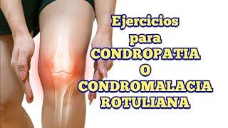 Ejercicios para CONDROPATIA o CONDROMALACIA ROTULIANA