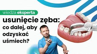 IMPLANTACJA NATYCHMIASTOWA BEZBOLESNE USUWANIE ZĘBÓW I WSZCZEPIENIE IMPLANTU PO EKSTRAKCJI