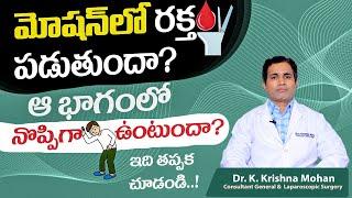 పైల్స్ కు పరిష్కారం | What is Piles? | Symptoms and Treatment of Piles in Telugu || Renova Hospitals