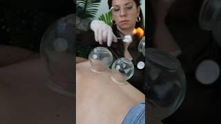 ASMR Tomorrow’s Video is Going To Be Back Fire Cupping #chiropractor #asmrsleep