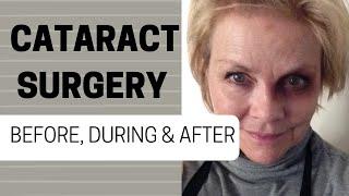 CATARACT SURGERY #1 | FROM A PATIENT'S PERSPECTIVE