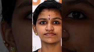 A Successful Jaw Surgery Result - Before And After | Best Jaw Surgery In Kerala