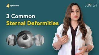 Sternum | Bone Anatomy | 3 Common Sternal Deformities | Skeletal System | V-Learning™