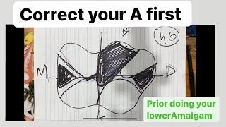 ADC- Amalgam task principles- Learn your A first prior doing your Lower Amalgam