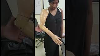 | Myoelectric Hand in Delhi | Above Elbow Prosthesis | Nakli Hath | Mechanical Elbow | #naklihath