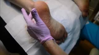 Comfortable Foot Injections Using the VAD Heel